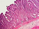 Histology Atlas Online®: Stomach – Slide 08