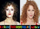 Bernadette Peters Plastic Surgery Before And After | Plastic Surgery ...