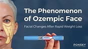 Ozempic Face Changes | Dr. Diana Ponsky Facial Plastic Surgery