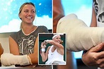 Petra Kvitova to play at Wimbledon just seven months after horrific ...