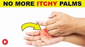 Why Do I Have Itchy Palms | Itchy Palms Treatment | Palm Itching Reasons - YouTube