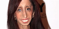 Lizzie Velasquez, 'La Mujer Más Fea del Mundo' quiere ayudar a víctimas ...