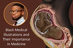 Black Medical Illustrations and Their Importance in Medicine | Harvard ...