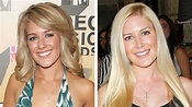 Heidi Montag on Her Plastic Surgery Past: "I Became Consumed by This ...