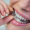 牙齒矯正 |透明牙箍 Invisalign |傳統箍牙 - 康霖牙科