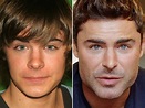 Zac Efron Before and After: From 2004 to 2022 - The Skincare Edit