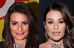 Lea Michele Nose Job Plastic Surgery Before and After Photos - Latest ...