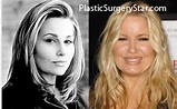 Jennifer Coolidge before and after plastic surgery. I don't think she ...