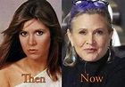 Carrie Fisher Plastic Surgery: Before and After Rumor