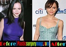 Christina Ricci Plastic Surgery Before and After | Plastic Surgery Magazine