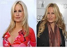 Jennifer Coolidge Plastic Surgery Before and After - CELEB-SURGERY.COM