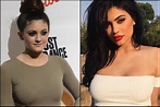 Kylie Jenner on Never Having Surgery on Her Face (Photos ...