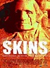 Skins (2002 film) - Wikipedia