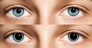 Pupille dilatée : quelles en sont les causes ? - Le Bien-Être Pour Tous
