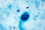 Public Domain Picture | Entamoeba histolytica trophozoite. Parasite ...