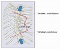 Ângulo de Cobb e Índice de Risser :: Referências Radiológicas