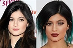 Kylie Jenner Plastic Surgery Before and After | Celebie