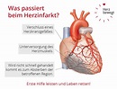 Was passiert beim Herzinfarkt? - Herz bewegt