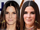 Sandra Bullock Plastic Surgery Comparison Photos