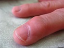 請教大家，我老媽的手指頭到底怎麼回事？一個憂心忡忡的兒子 - Mobile01