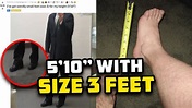 5 Foot 10 Man With Size 3 Feet Seeks Answers - YouTube