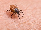 Lyme disease and ticks: Ask an expert your questions about how to ...