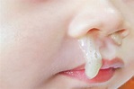 What Your Snot Says About Your Health - Holistic Living Tips