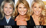 Christie Brinkley Plastic Surgery: Breast Implants, Botox Injections