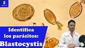 Conoce a Blastocystis spp: Mofología y CLAVES para su identificación ...