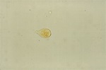 Giardia Lamblia Cyst Under Microscope - Micropedia