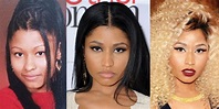 Nicki Minaj Plastic Surgery Before and After Pictures 2018