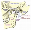 Temporomandibular ligament - Wikipedia