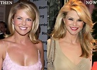 Christie Brinkley Plastic Surgery Before and After Breast Implants ...