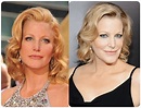Anna Gunn Plastic Surgery Before And After Botox, Facelift Photos ...