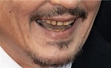 Johnny Depp’s teeth visibly rotting, fans react in disgust