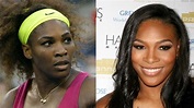 Serena Williams' Plastic Surgery: Rumors of A Nose Job, Breast Implants ...