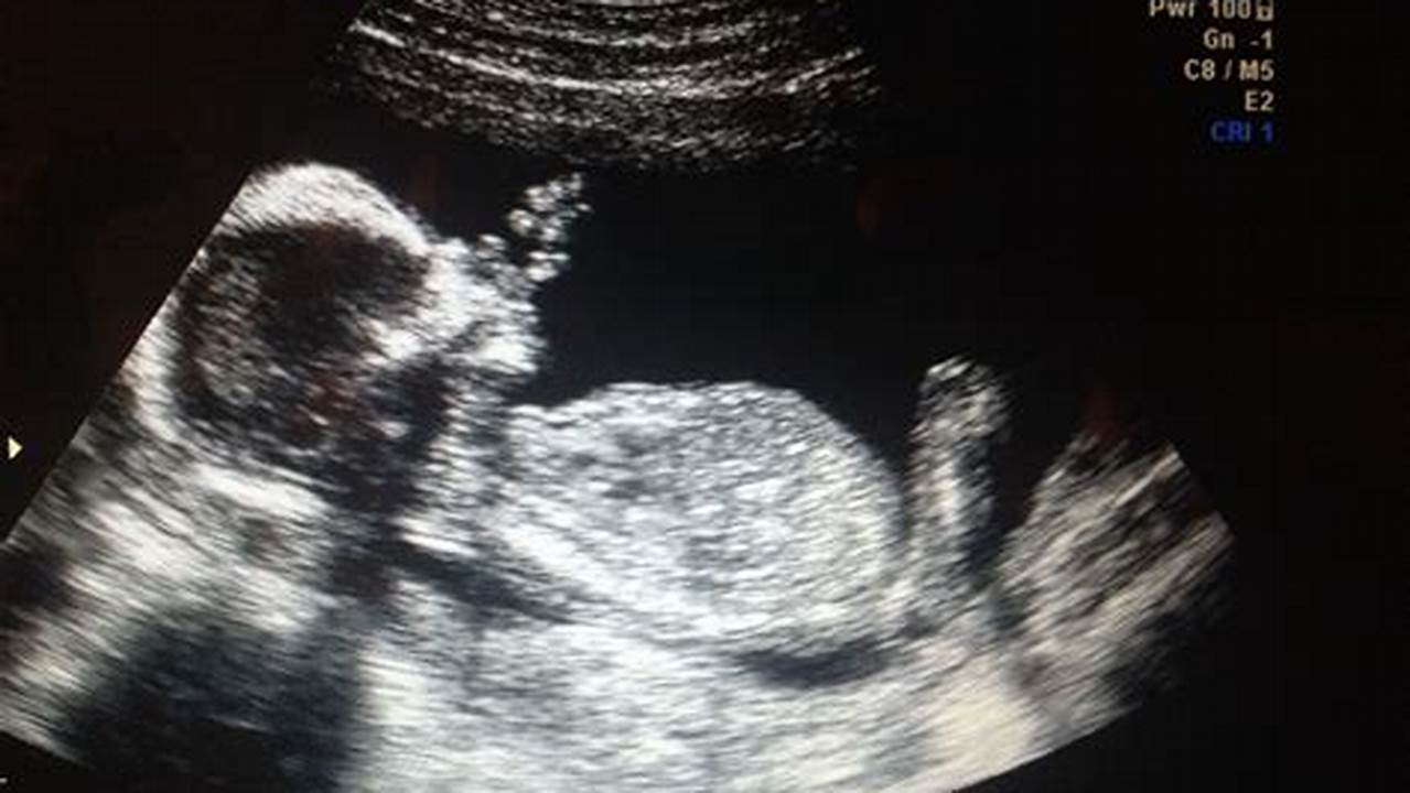 Witness Your Baby's World with a 15 Weeks Pregnant 4D Ultrasound