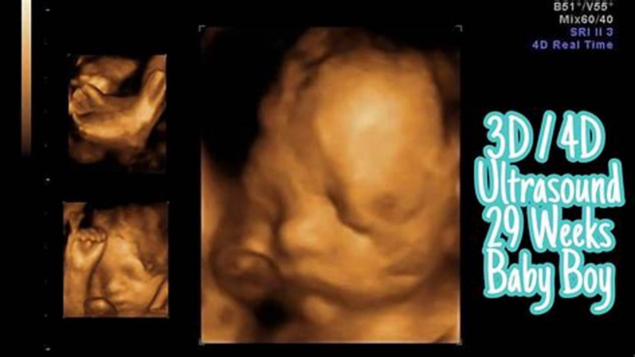 Your Guide to 29 Weeks Pregnant 3D Ultrasound: Everything You Need to Know