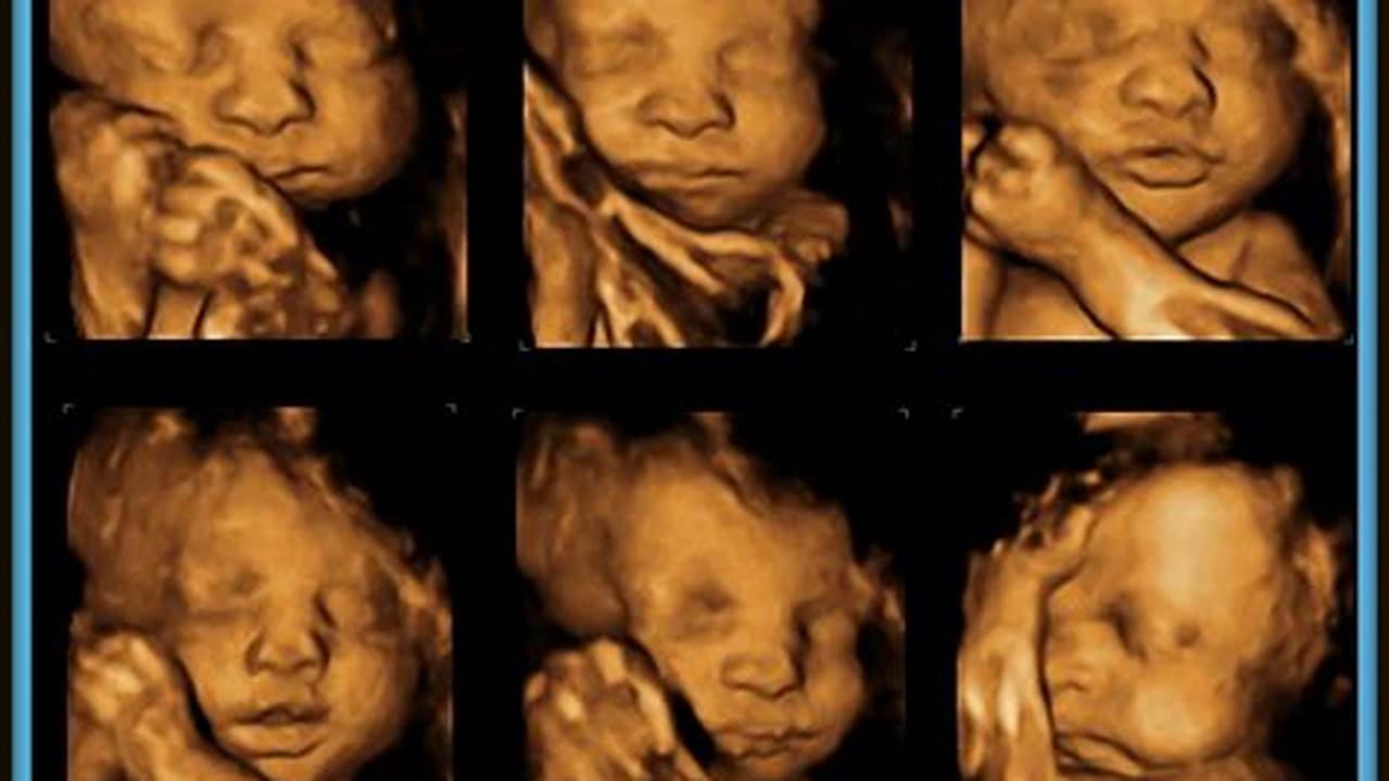 Revealing Your Baby's World: The Ultimate Guide to 30-Week Pregnant Ultrasound 3D