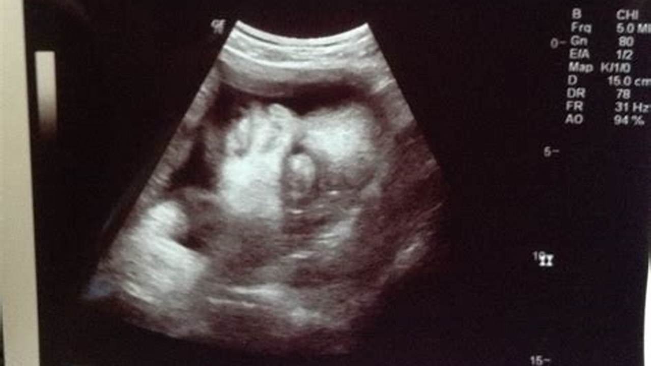 A Deep Dive into 35 Weeks Pregnant 3D Ultrasound: Everything You Need to Know