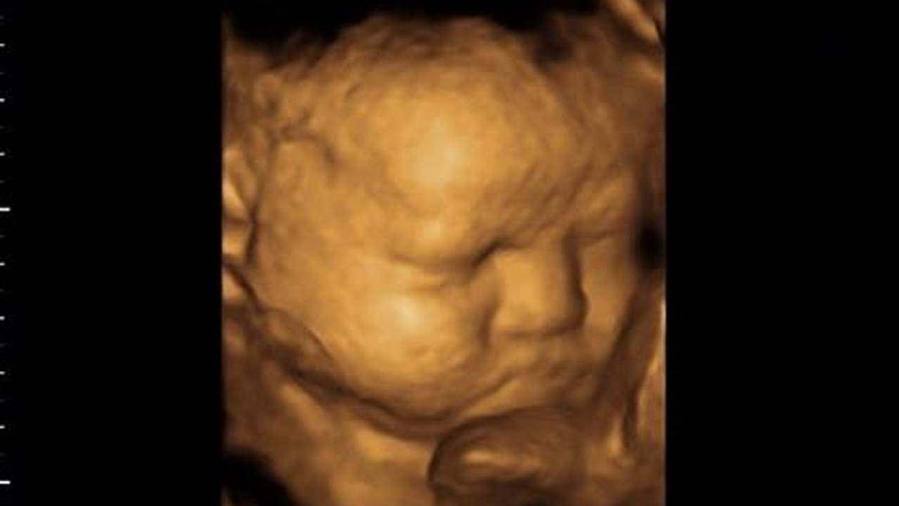 Unveil Your Baby's World: A Guide to 36-Week 3D Ultrasound