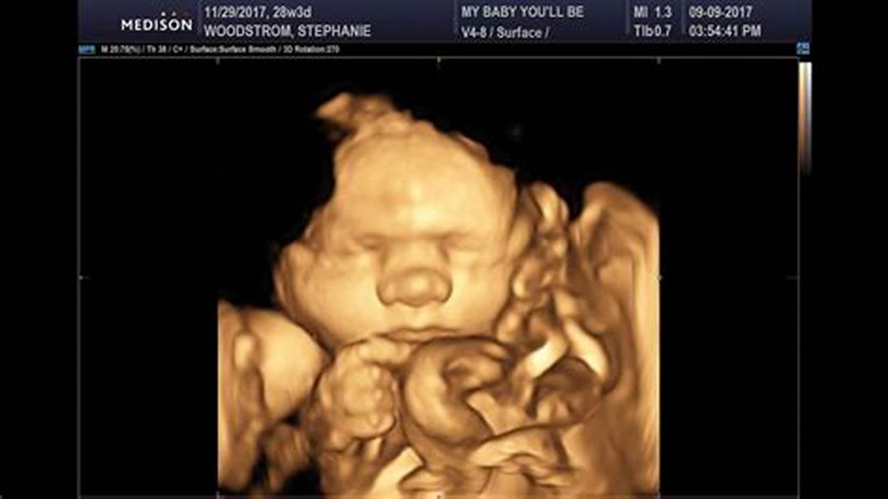 Unveil Your Baby's World: A Guide to 3D Ultrasound Images at 28 Weeks
