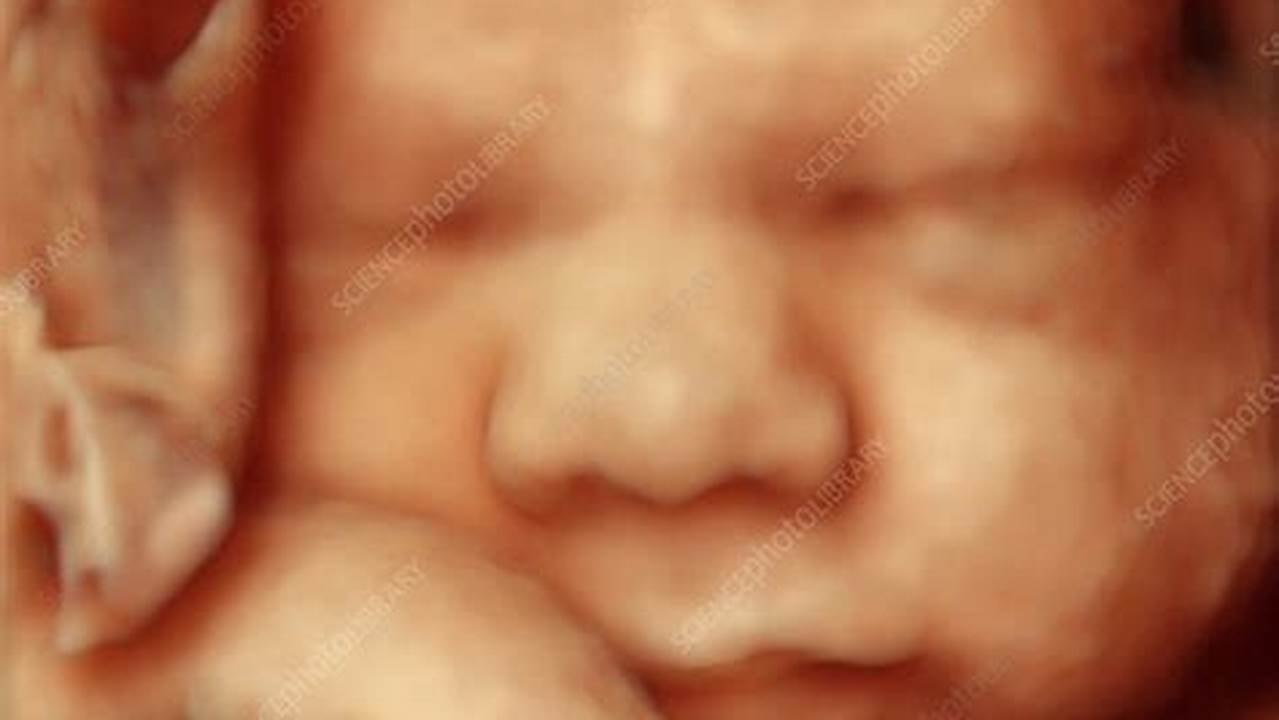 Unlock Your Baby's World with 3D Ultrasound Pictures at 32 Weeks