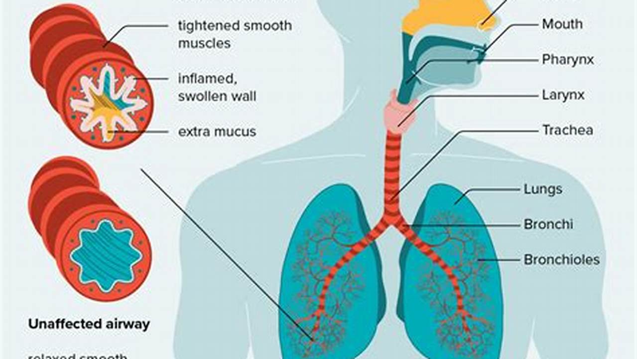 Asthma Is A Disease That Affects Your Lungs., 2024