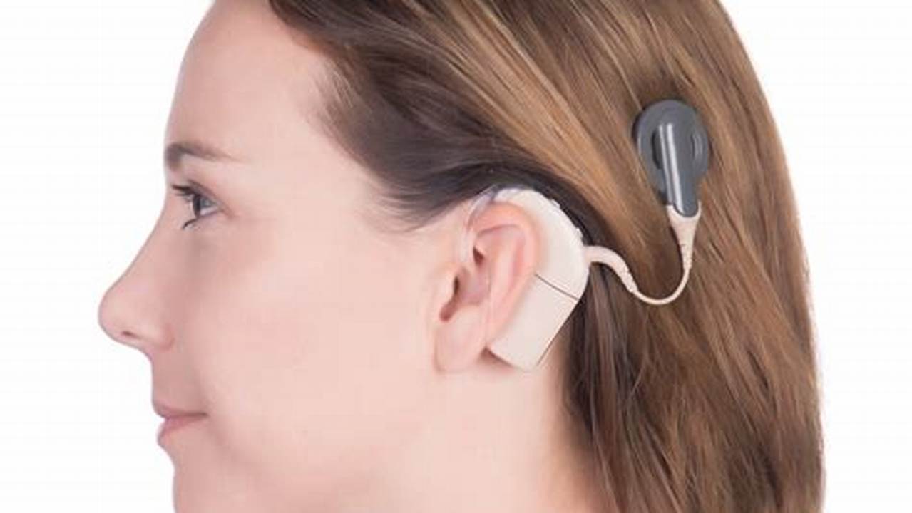 Best Cochlear Implant 2024