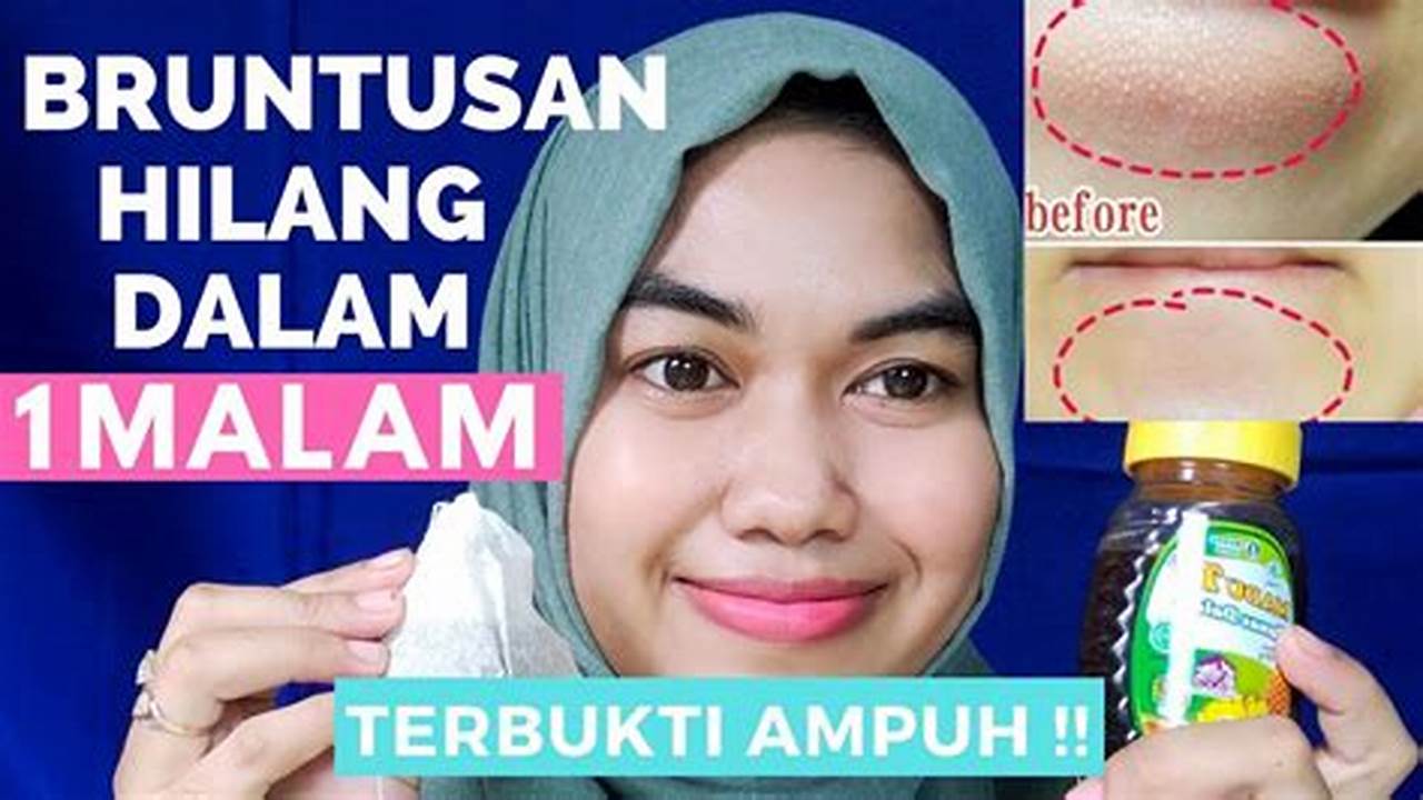 Rahasia Wajah Bebas Bruntusan: Temukan Solusi Alami yang Terbukti!