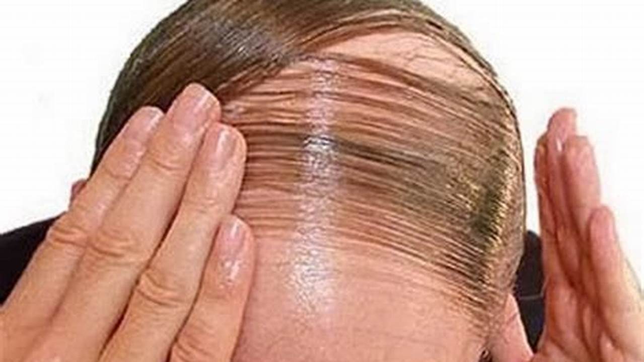 Cara Mengatasi Kebotakan, Penumbuh Rambut
