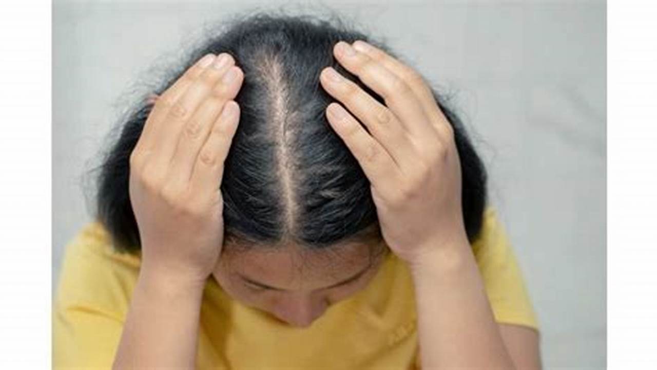 Dampak Psikologis Kerontokan Rambut, Penyakit Rambut