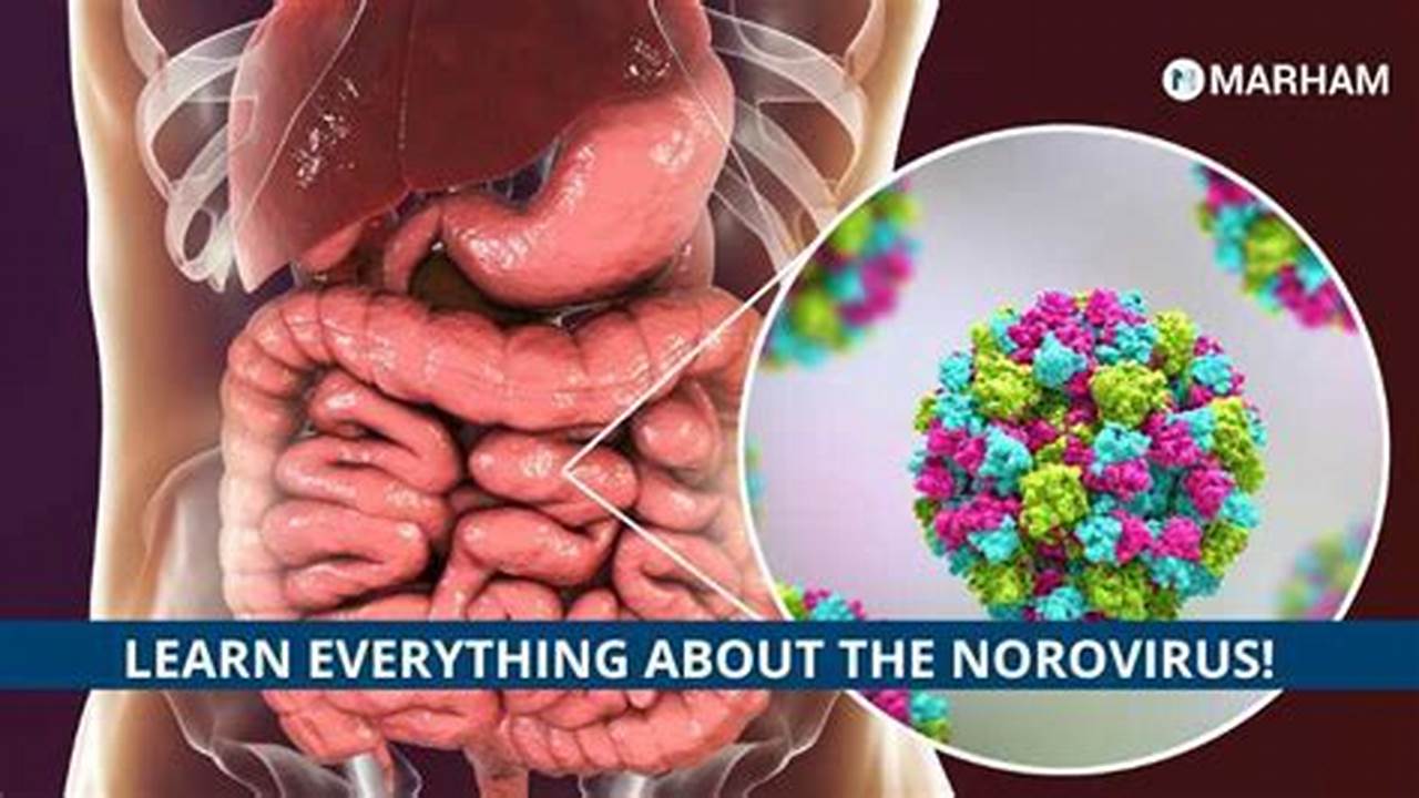 It Could Be Norovirus, The Stomach Virus Going Around New Jersey., 2024