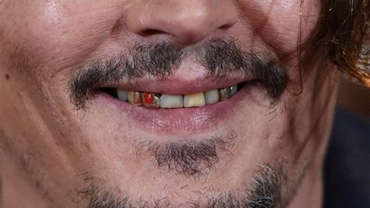 Johnny Depp Teeth 2024